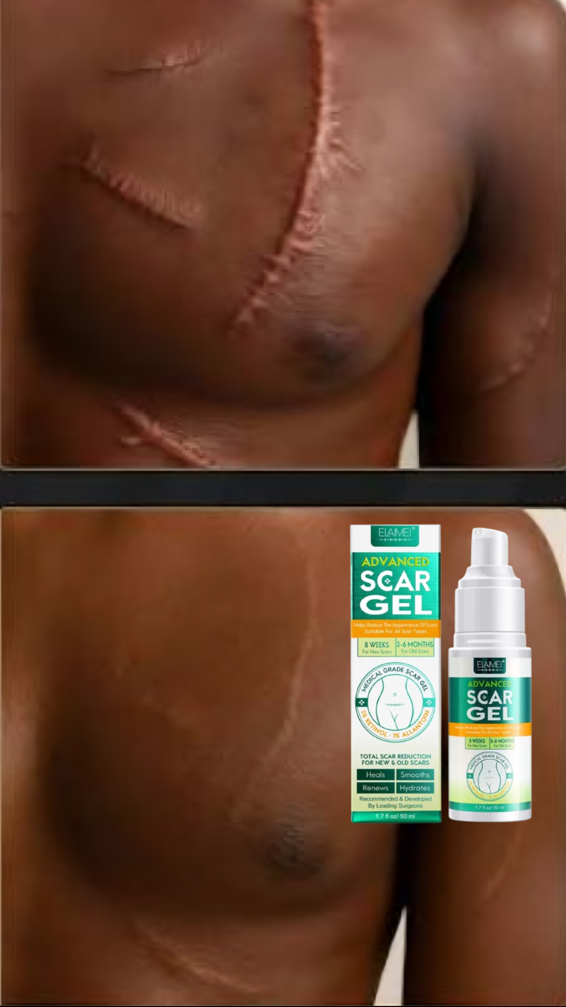 🔥 GEL DE CICATRICE AVANCÉ