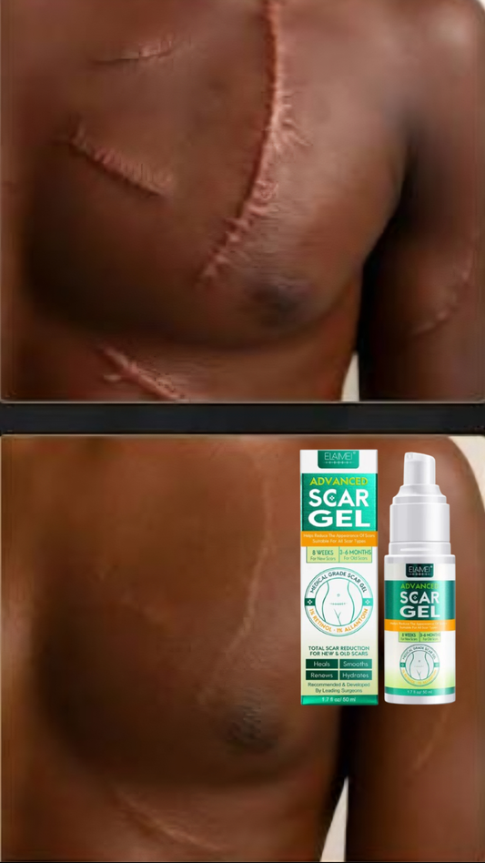 🔥 GEL DE CICATRICE AVANCÉ
